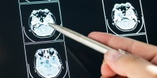 Impact Of Medical Imaging On Healthcare